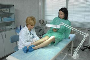 Lasertherapie bei Krampfadern in den Beinen. 